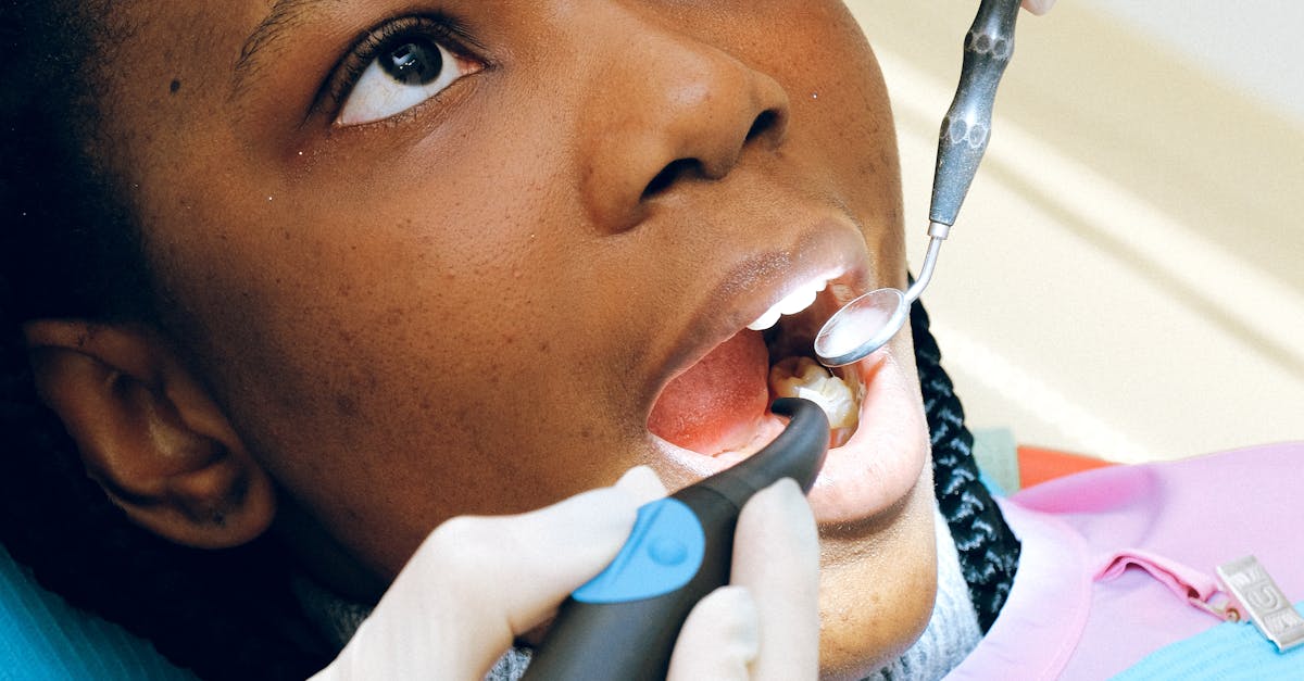 Best Foods for Strengthening Tooth Enamel