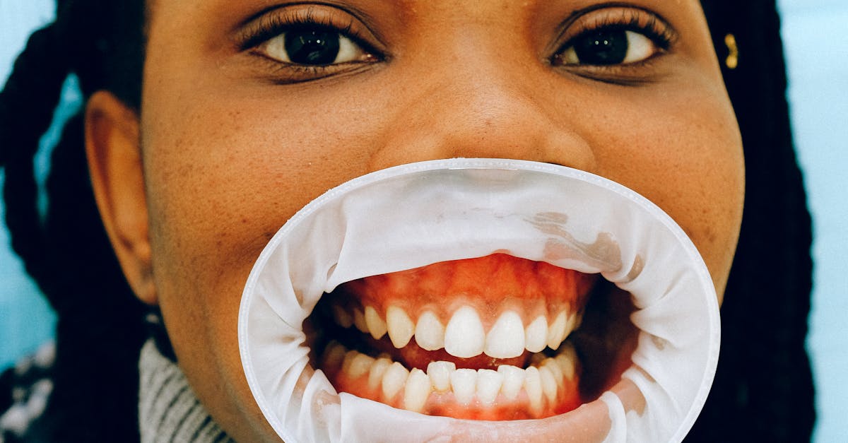 Comprehensive Dental Examinations for Optimal Oral Health