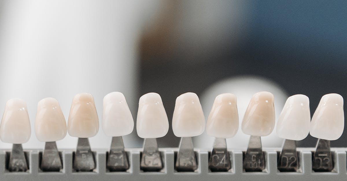 Exploring the Dentist's Experience with Specific Procedures