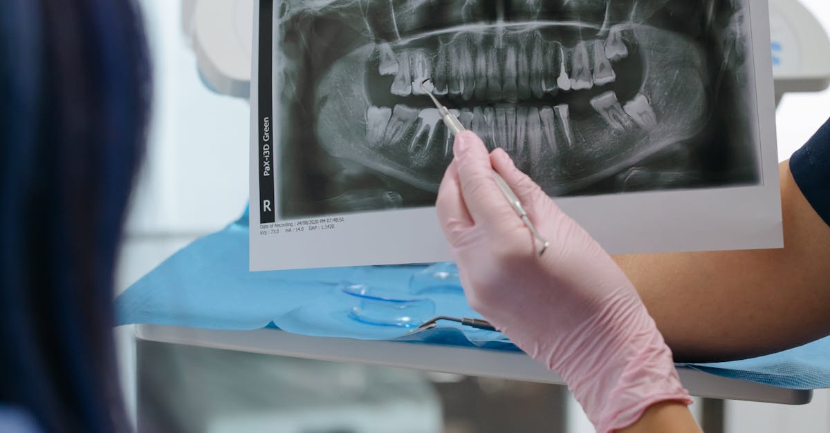 Exploring the World of Dental Bonding