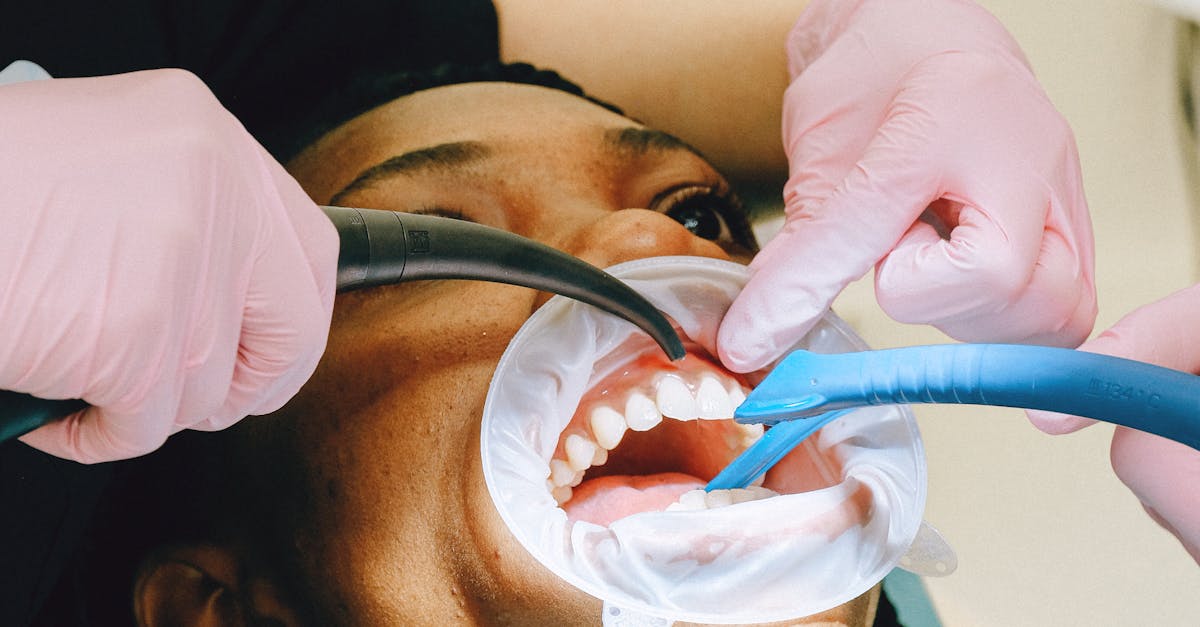 The Importance of Dental Cleanings in Preventing Disease