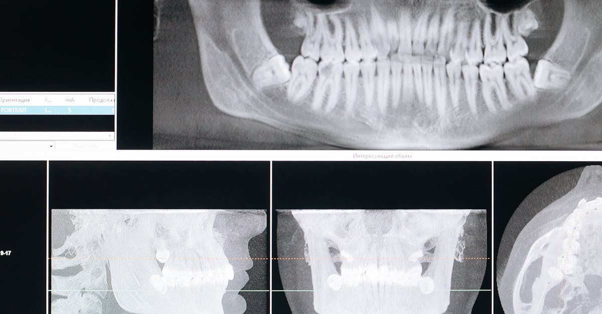 Understanding the Impact of Oral Care on Overall Health
