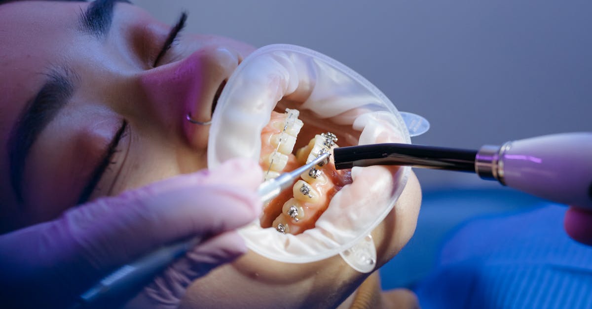 Understanding the Recommended Frequency for Dental Visits