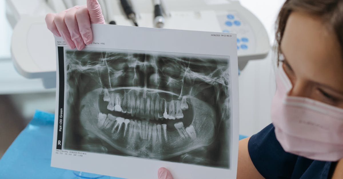 When to Consult an Endodontist for Root Canal Treatment